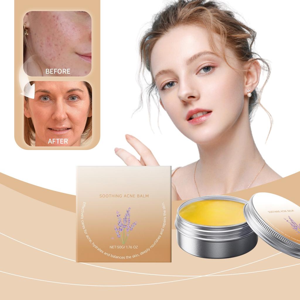 Acne Cream Dot Cream Acne Scar Skin Cream For Natural Gel For The Face  50G