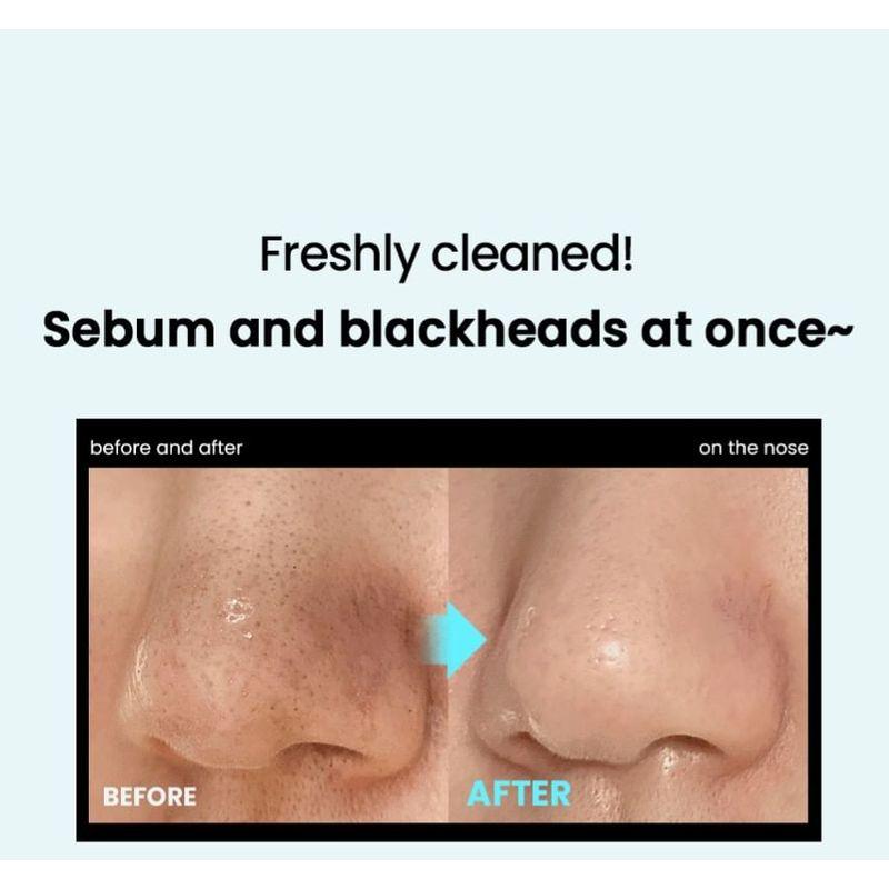 ilso - Super Melting Sebum Softener Special Set
