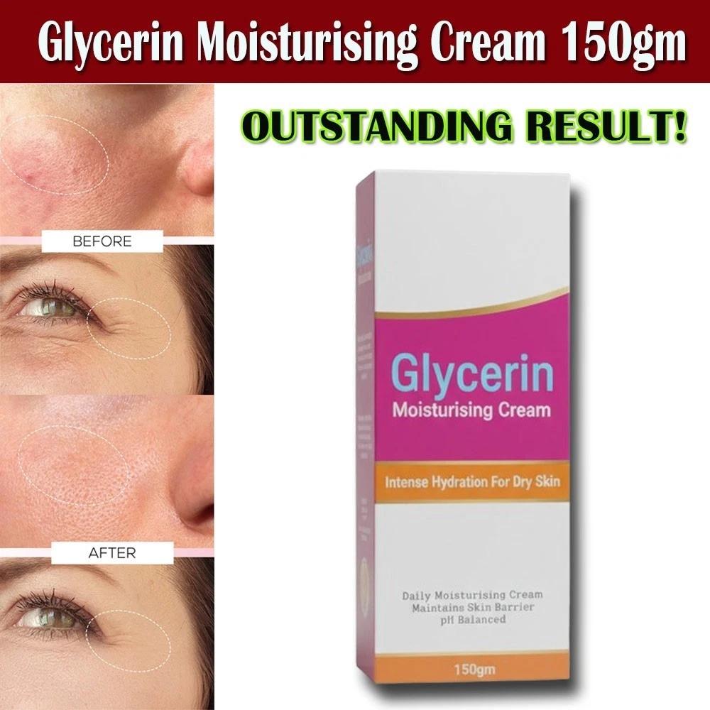 Glycerin Moisturising Cream for Dry Skin – Intense Hydration, Skin Barrier Repair & Daily Moisturizer (150g)
