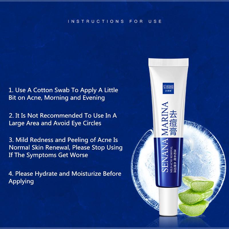 Acne Cream Moisturizing Oil Control Fade Acne Marks Mild Non-irritating