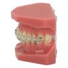 Modello Dimostrativo Ortodontico Dentale Modello di Denti con Fili Metallici e Bracket per Insegnamento