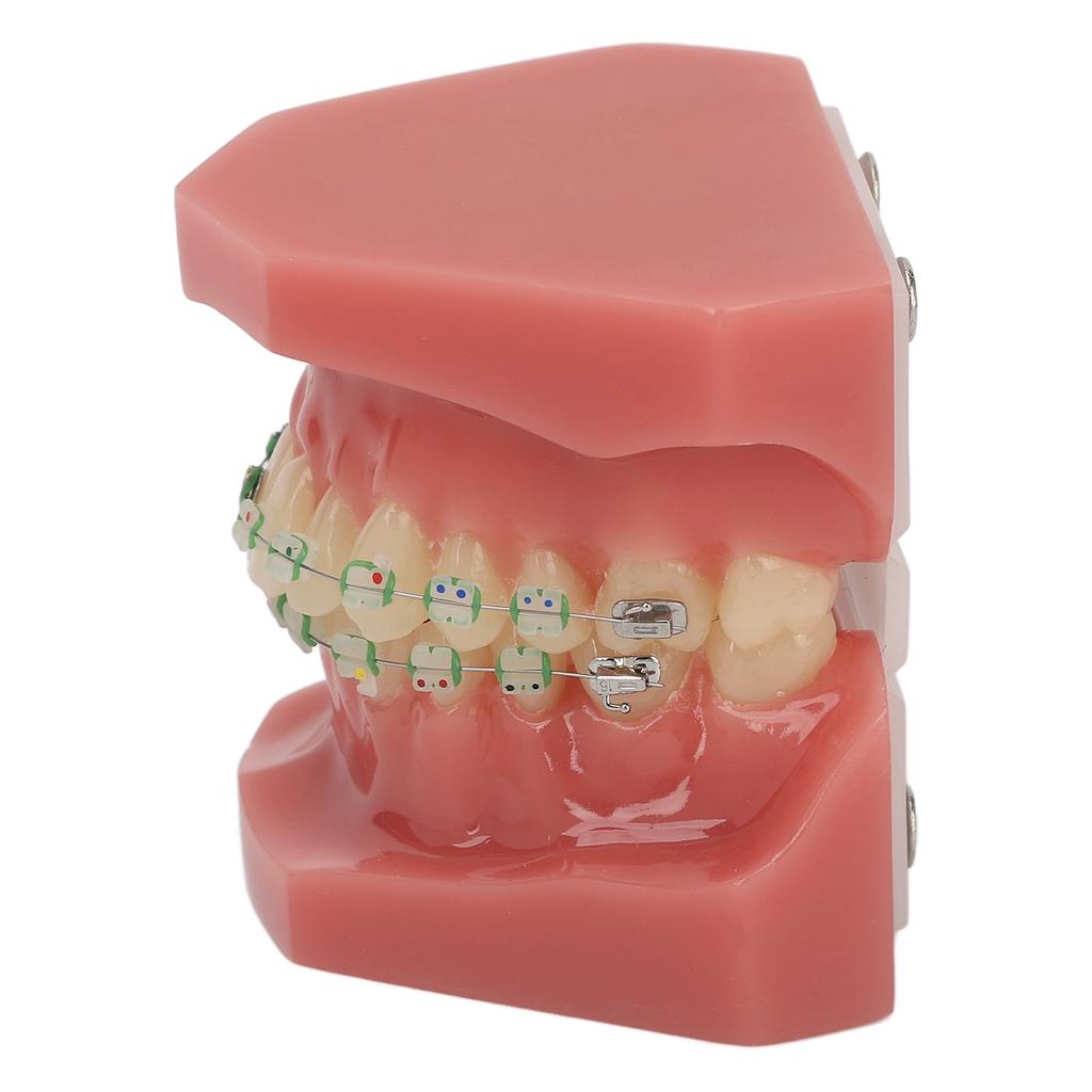 Modello Dimostrativo Ortodontico Dentale Modello di Denti con Fili Metallici e Bracket per Insegnamento