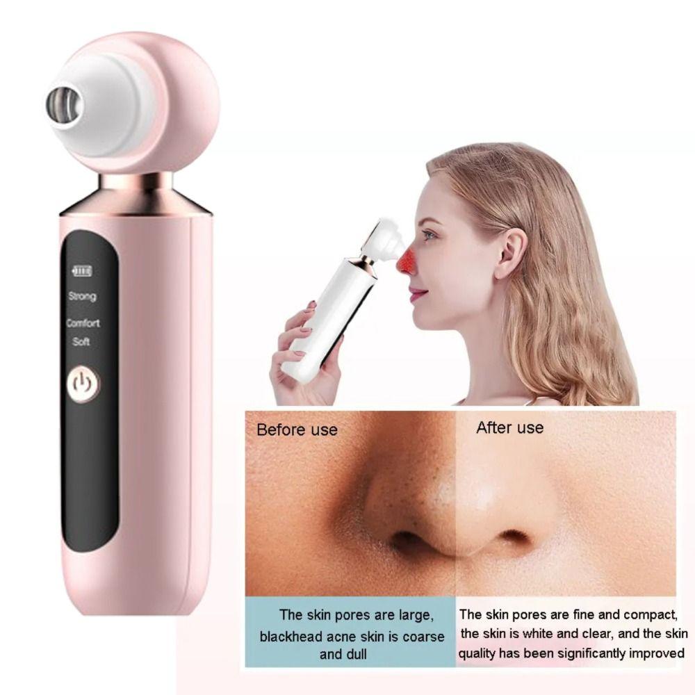 Visual Facial Blackhead Removal Instrument Pore Cleanser Blackhead Sucker  Skin Care