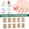 Ingrown Toenail Correction Stickers Hands And Feet Soft Nail Inlaid Nail Thickening Bright Nail Furrow Gray Nail Care Patch 50pcs
