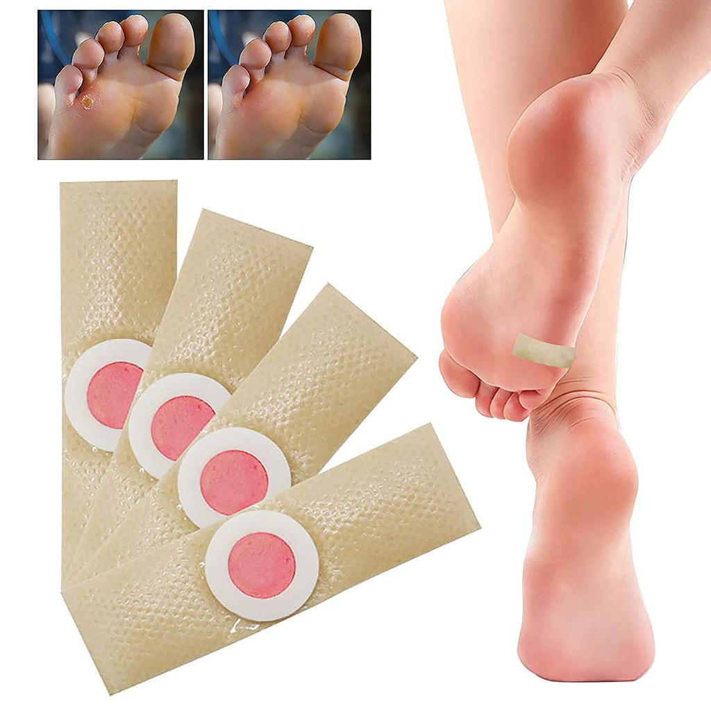Foot Corn Removal Killer Calluses Plantar