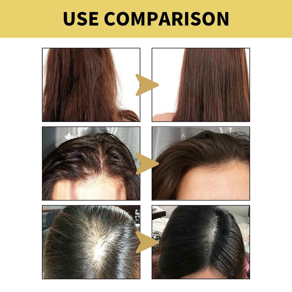 OUHOE Ginger Anti-Hair Loss Shampoo 100ml - Anti-Hair Loss, Strengthens Hair, Removes Dandruff, Controls Oil, and Thickens Hair.