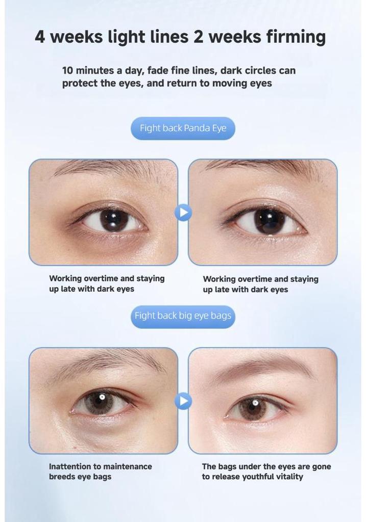 EMS Microcurrent Eye Massager for Dark Circles with Heat Therapy