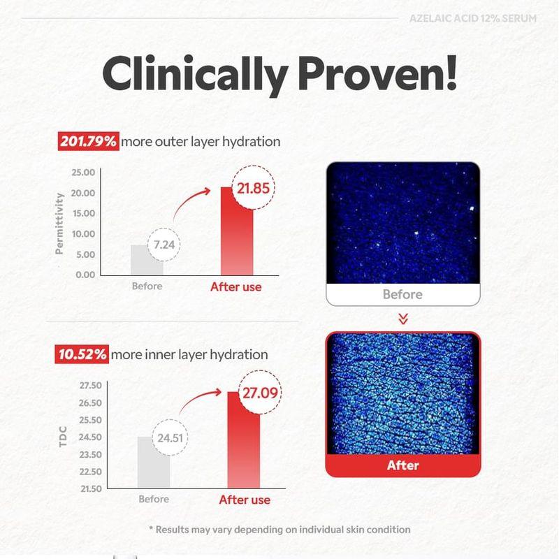 TIRTIR - Azelaic Acid 12% Serum