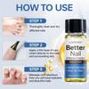 Better Nail-Strengthen Weak Nails-Moiturize And Brighten Toenails-Suitable For Hands And Toes, 15ml