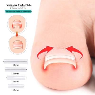 Fourth Gen Titanium Ingrown Nail Orthotic Patch