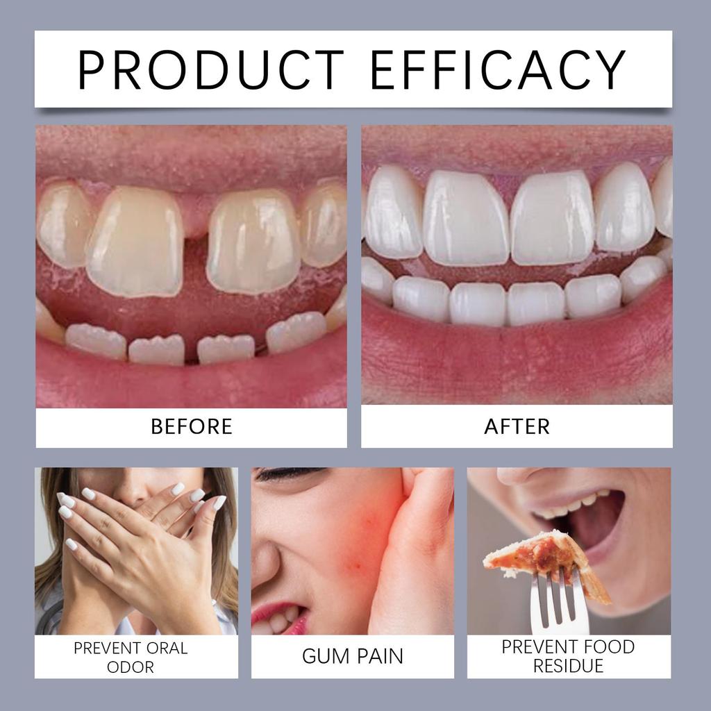 Oralhoe Lepidlo na zubní protézy, silné a dlouhotrvající, zabraňuje uvolnění zubní protézy, fixační gel na zubní protézy 40g