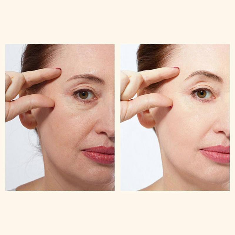 Facial Peeling Serum with 45% Citric Acid, Chemical Exfoliant for Face Exfoliating, Peeling Solution, for Acne Dark Spots Wrinkles