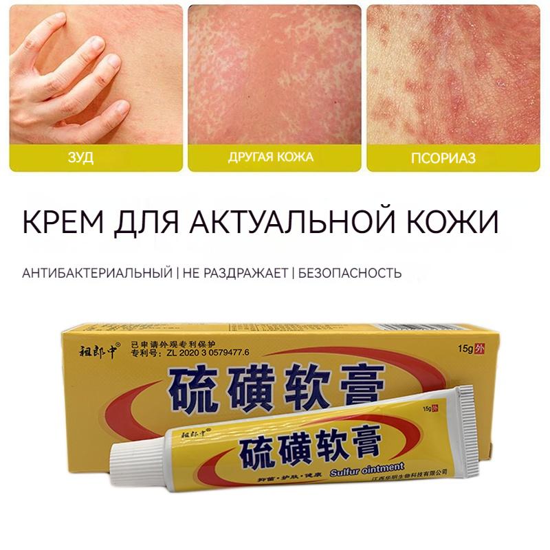 sulfuric Moss Care Relieves Skin Itching, Redness, And Swelling. Cowhide Moss Moisturizing Skin Care