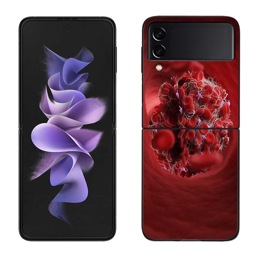 

Blood Platelets Under Microscope Phone Case For Samsung Z Flip 7 6 5G Galaxy Z Flip 5 4 3 Black Hard Cell Cover Luxury PC Shell Samsung Z Flip 4 5G