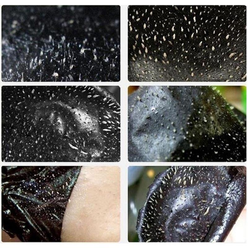 20 szt. Pasta do nosa z zaskórnikami Czyste pory Usuwają granulki tłuszczu, blokują pory, zaskórniki i Whitehead