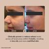 Pore Perfecting Korean Face Serum with Lotus Water, Galactomyces & Bifida Ferment |Vegan Korean Skincare for Men & Women | 30ml