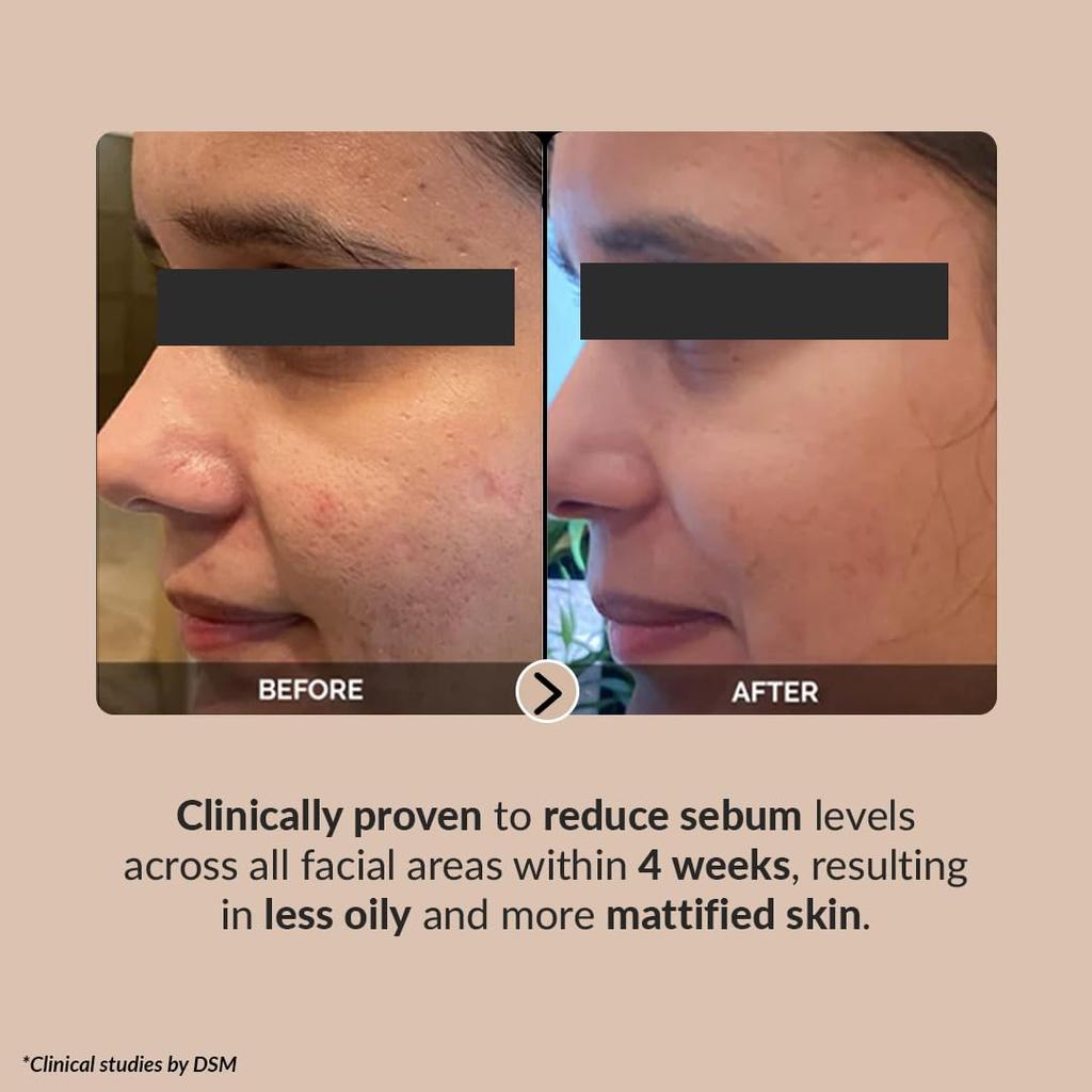 Pore Perfecting Korean Face Serum with Lotus Water, Galactomyces & Bifida Ferment |Vegan Korean Skincare for Men & Women | 30ml