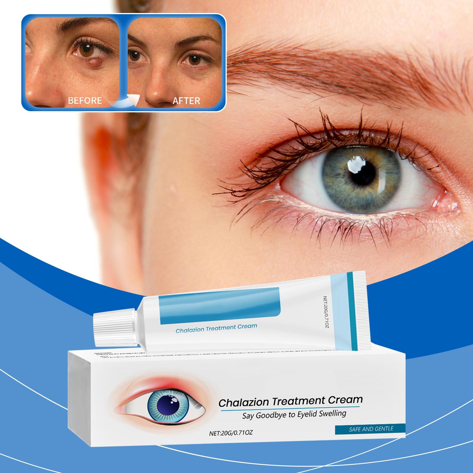 

Успокаивающий крем для кожи вокруг глаз Stye Eye Soothing Cream. Укрепляющий крем для кожи вокруг глаз осветляет морщины, увлажняет и уменьшает темные круги. One Size белый