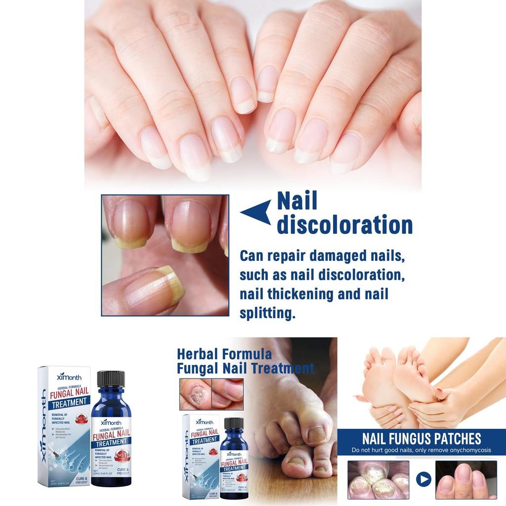 Ximonth Nährende Formel für gesunde, starke, weiche Nägel und Nagelhautpflege