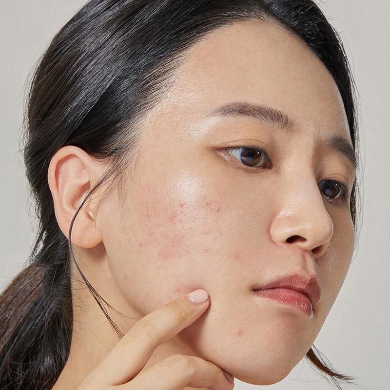 COSRX Akne Pickel Master Patch 24 Pflaster*1 Stück