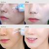 Dewycel Cream 50ml [DEWYCEL] Tone-On