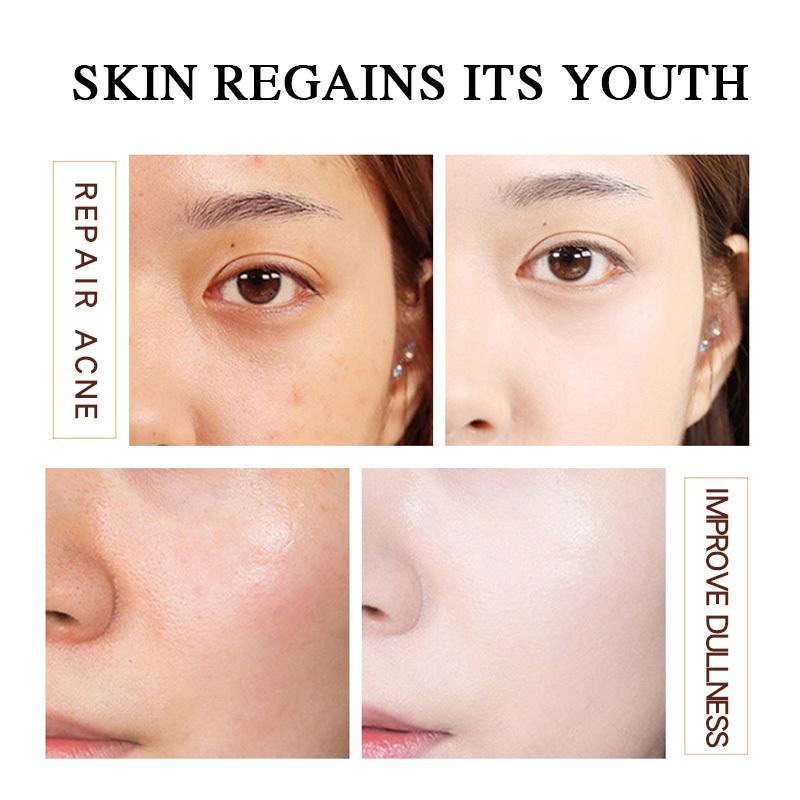Moisturizing Face Cream with Retinol and Hyaluronic Acid for Deep Hydration