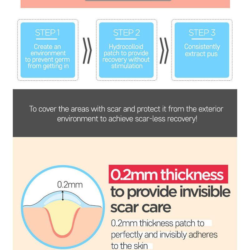 G9SKIN - Zero Solution Spot Cover Patch 108pcs