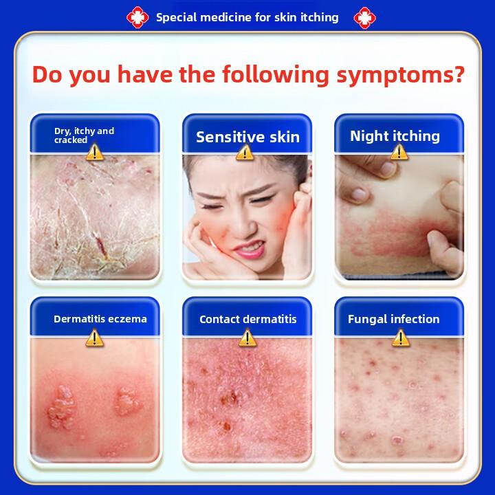 Anti-Itch Cream 50g Large Size, Fast Relief for Eczema, Fungal, Dermatitis & Skin Rashes, Antiseptic