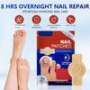 Waterproof Nail Repair Patch Toenail Fungus Patch Nail Ingrown Correction Stickers for Discolored or Damaged Nail Foot Care Tool