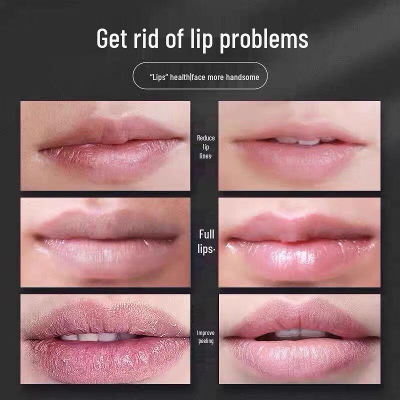 Image Beauty Vaseline Hydrating Lip Balm