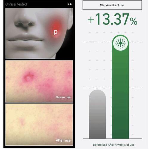 Anua Heartleaf Centella Red Spot Cream 30g