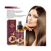 Onion Hair Growth Oil 30ml, Anti-Hair Loss Nourishing Essential Oil for Stronger Roots and Healthy Scalp