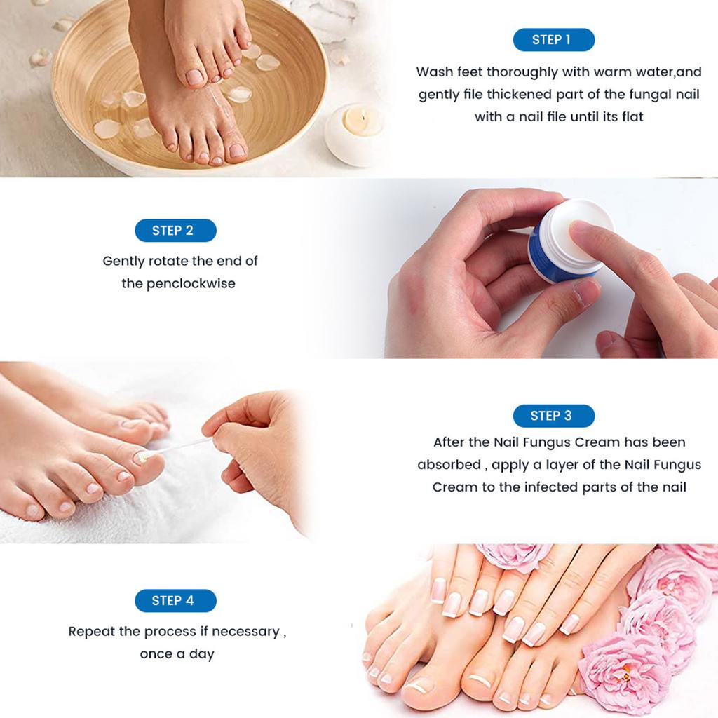 Gips Ny Bright Nail Plaster Lindrer Onychomycosis Og Neglepleie