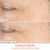 Dr. Dennis Gross SkinCare Vitamin C laCtiC Firm   Bright Eye Treatment