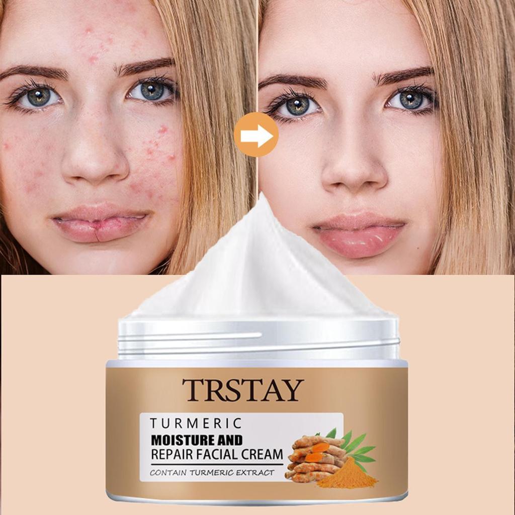 Rozjasňující krém hydratuje, je hladký a jemný, jemný a nedráždivý, redukuje jemné linky, hydratuje pokožku a zlepšuje poškozenou pokožku