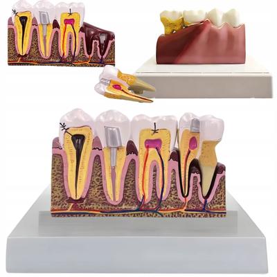Anatomical Tooth Model (16)