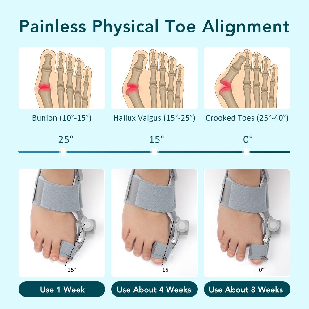 Bunion Corrector Big Toe Hallux Valgus Foot Brace Angle Adjuster Bone Thumb Straightener Orthopedic Strap Pedicure Care Tool