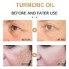 Turmeric Cream Dark Spot Corrector Skin Melasma Remove Wrinkles Serum Anti-Aging FT