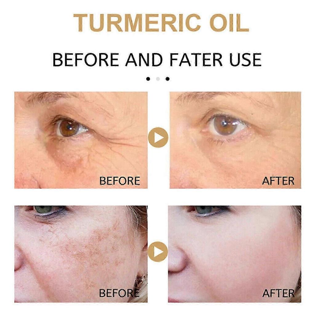 Turmeric Cream Dark Spot Corrector Skin Melasma Remove Wrinkles Serum Anti-Aging FT