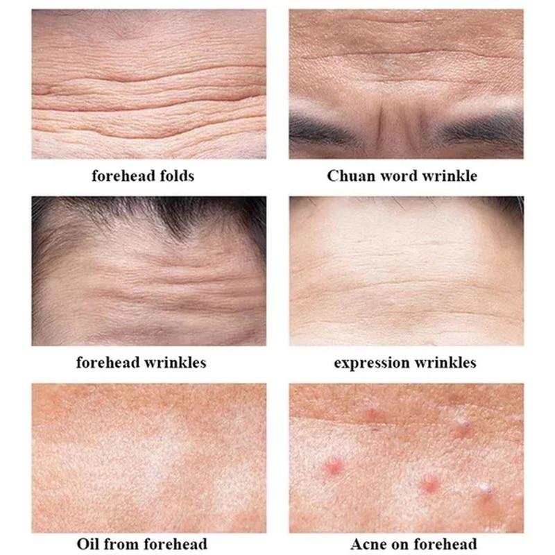 Patch de Gel Anti-rides pour l'élimination des lignes frontales, masque raffermissant, lignes de froncement, soins de la peau du visage, autocollants de traitement, Anti-âge, hydratant