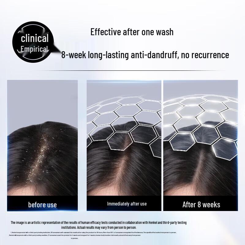 Schwarzkopf Anti-Dandruff Conditioning Shampoo Twin Pack