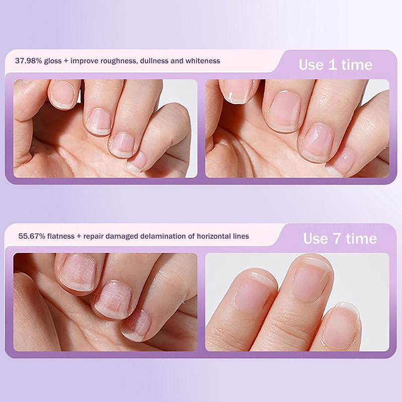 3v1 Keramický olej na nehtovou kůžičku Rozjasňující Hydratační Odstraňovač nehtové kůžičky v peru Vyživující Esence pro péči o nehty v peru Oprava poškození nehtů
