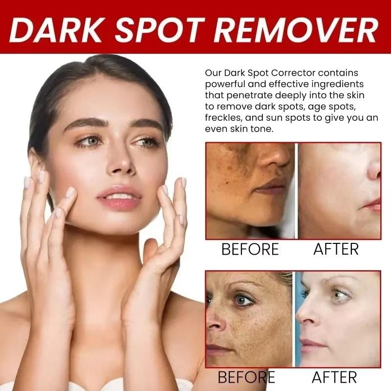 Whiten Cream Brighten Face Effective Remove Melasma Dark Spot Improve Dullness Skin Anti-pigmentation Care Cream Care Products