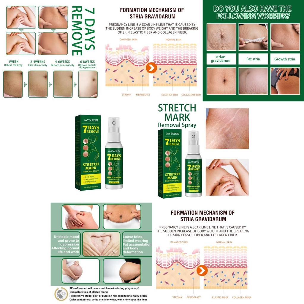 Jaysuing Skin Care Spray For Postpartum Skin Firming And Fine Line Reduction In 30ml Packaging