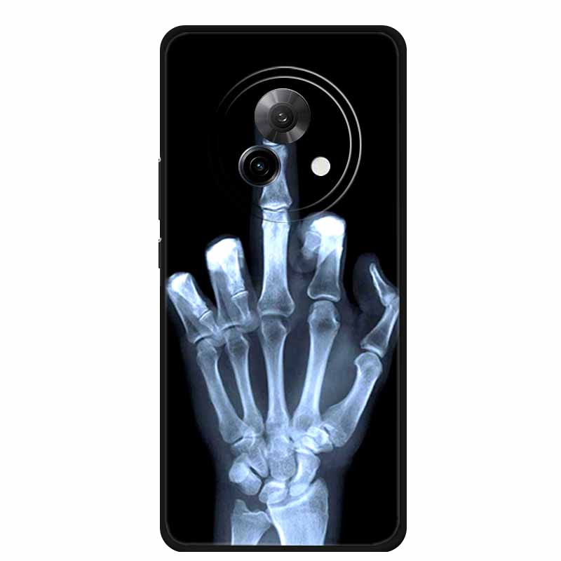 

For Meizu Lucky 08 Case Luxury Black Silicone Soft Phone Case For Meizu Lucky 08 Back Cover Case Lucky08 6.78 Protective Shell Meizu Lucky 08