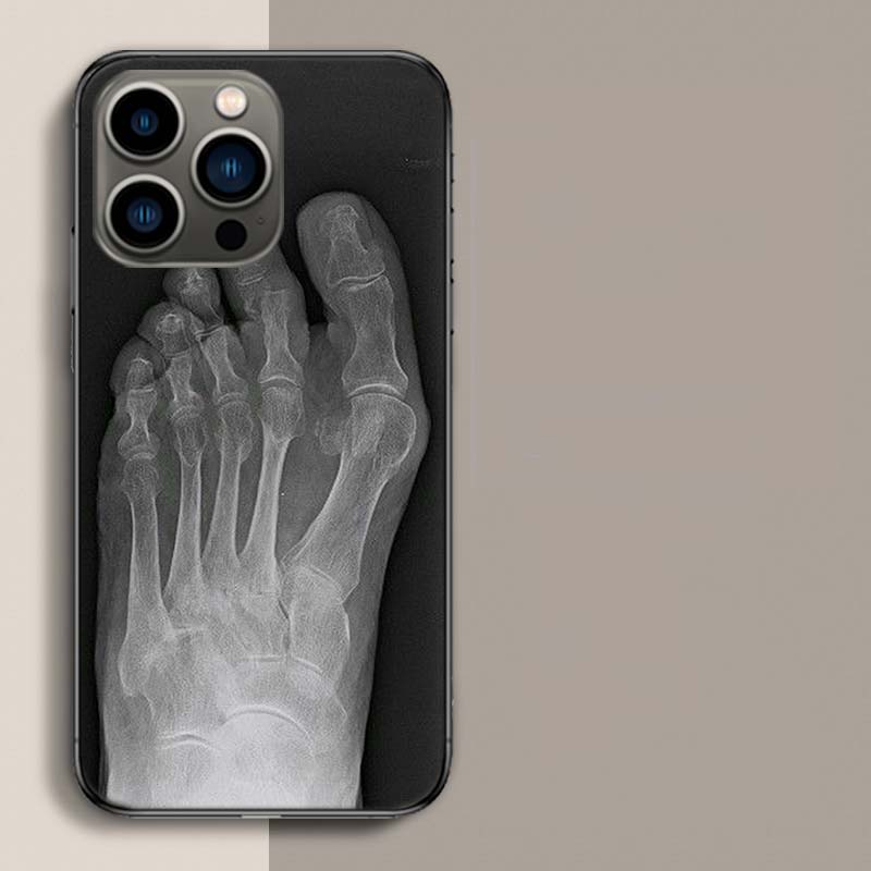 Herbst Röntgen Handknochen Handyhülle Für Apple Iphone 16E 16 17 Pro Max Air 15 Pro 14 Plus 12 13 Mini Hülle Niedliche Fundas Silico