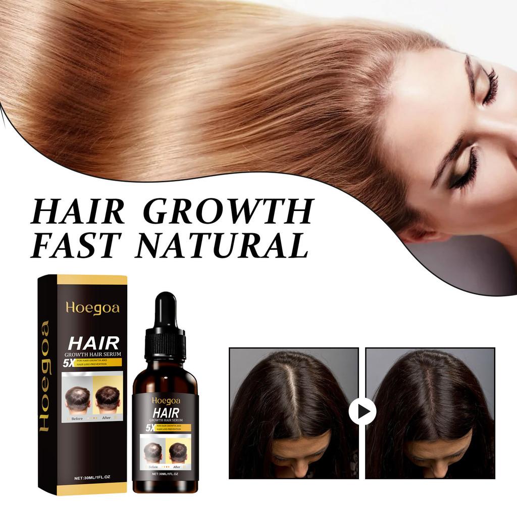 Hoegoa Ginger Infused Hair Essence For Revitalizing Dry Frizzy And Damaged Hair