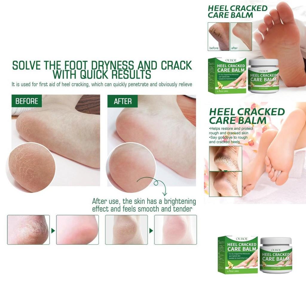 Ouhoe Cracked Heel Repair Cream Nourishing And Moisturizing Foot Balm For Soft Feet