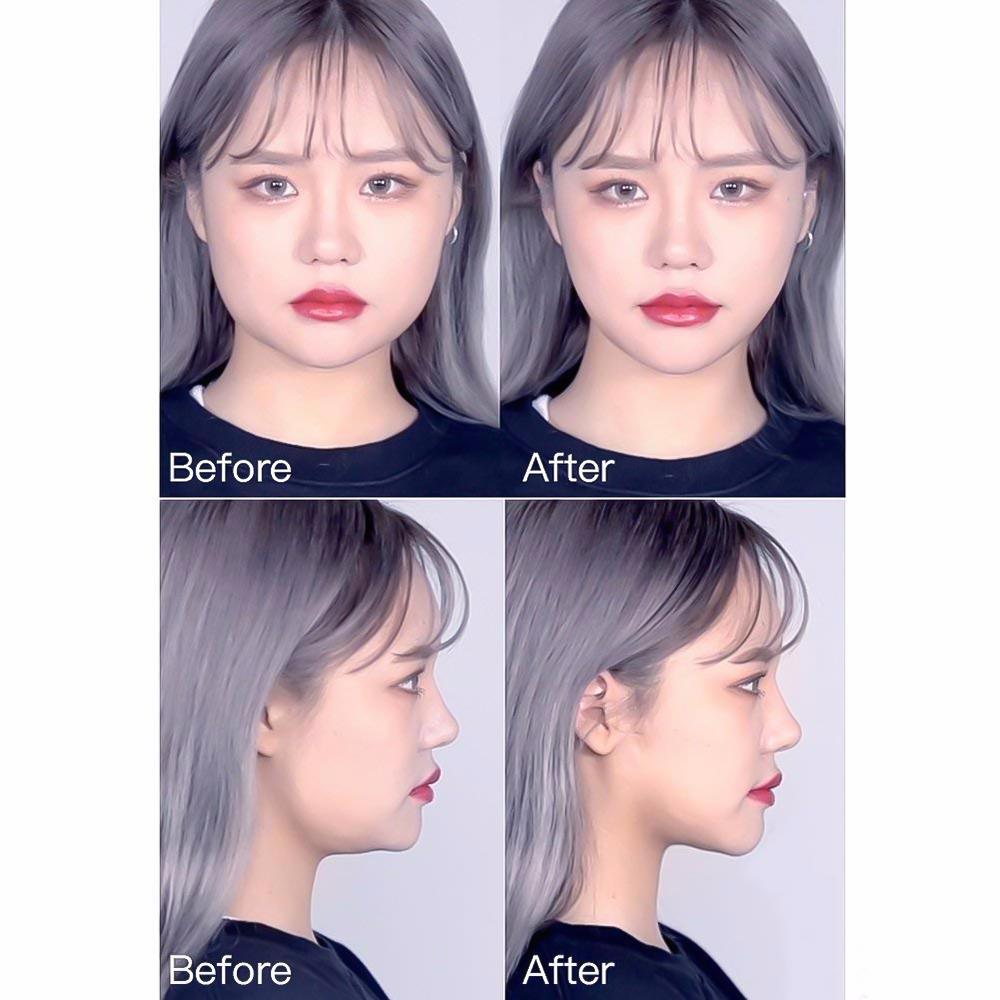 Face Shape Correction Bandage