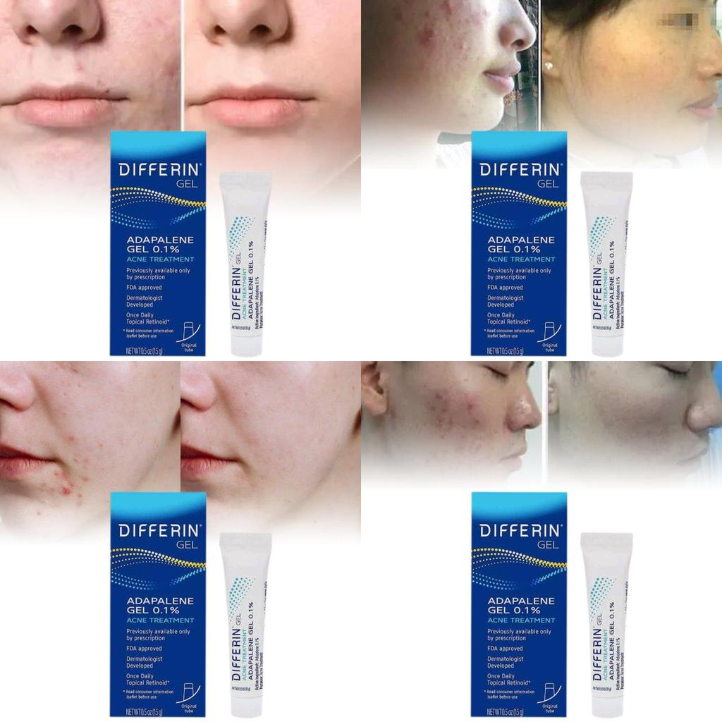 Differin Gel Traitement Acné Gel Rétinoïde Pour Peau Claire Radieuse 15g